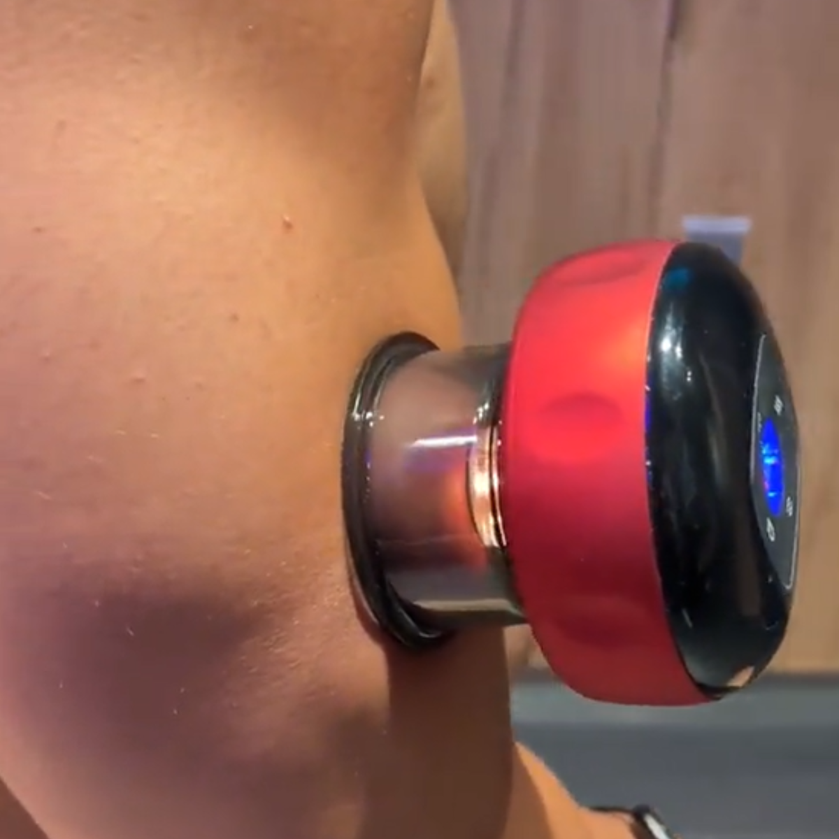 set2.png__PID:bbc217bb-4d9a-444d-a7ac-df5428a34a61